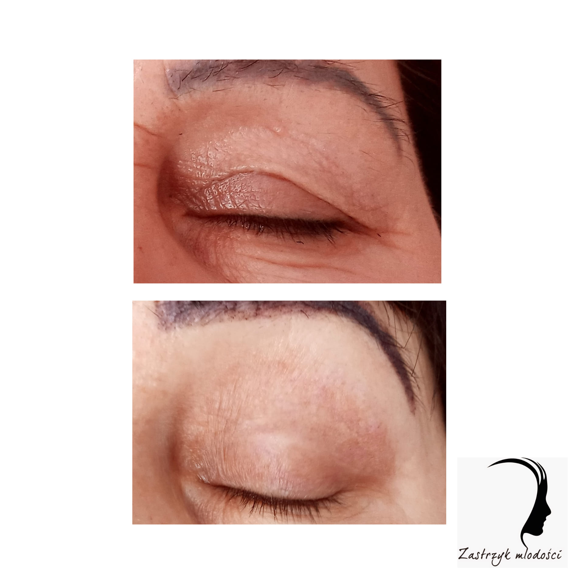 Zdjęcie ogłoszenia