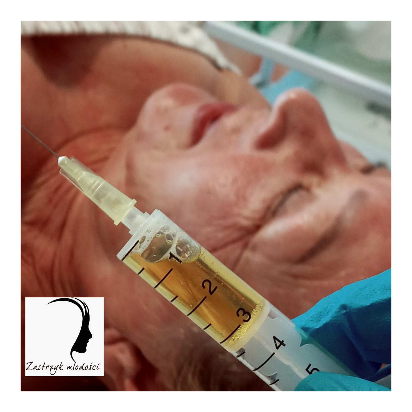 Zdjęcie ogłoszenia